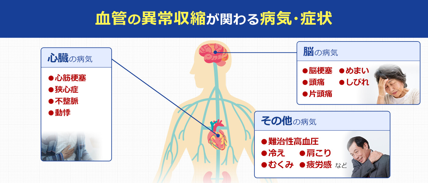 血管の異常収縮により危険な状態になった脳