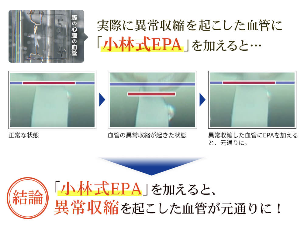 血管の異常収縮に小林式EPAを加えた実験