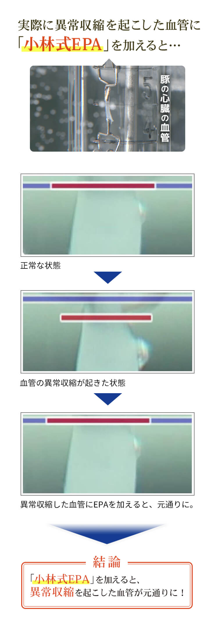 血管の異常収縮に小林式EPAを加えた実験