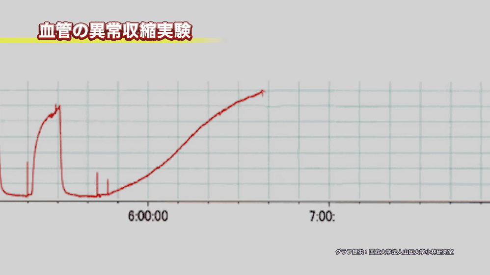 血管の異常収縮実験