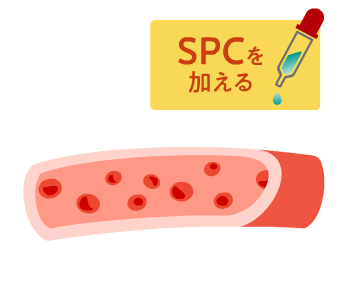 血管の異常収縮が起きた状態に