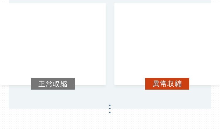 正常収縮 異常収縮