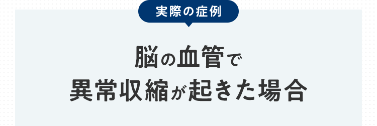 実際の症例 脳の血管で異常収縮が起きた場合